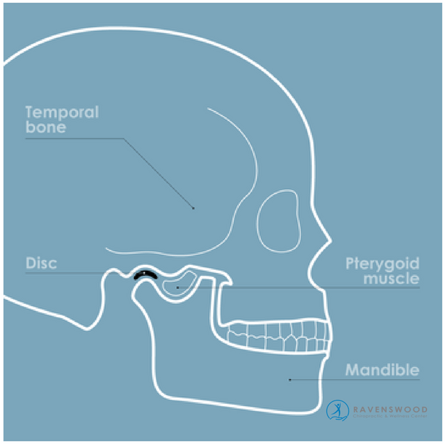 Location of TMJ Disorders - Skull Diagram