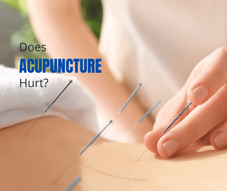 Does Acupuncture Hurt? Chicago Acupuncturist Inserts and Discusses What Acupuncture Feels Like